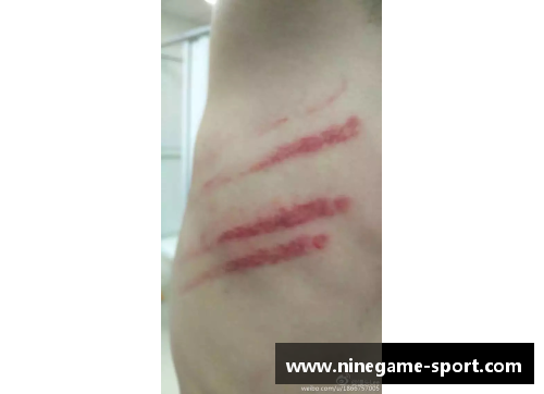 摩洛哥球员抓伤事件引发的讨论与反思